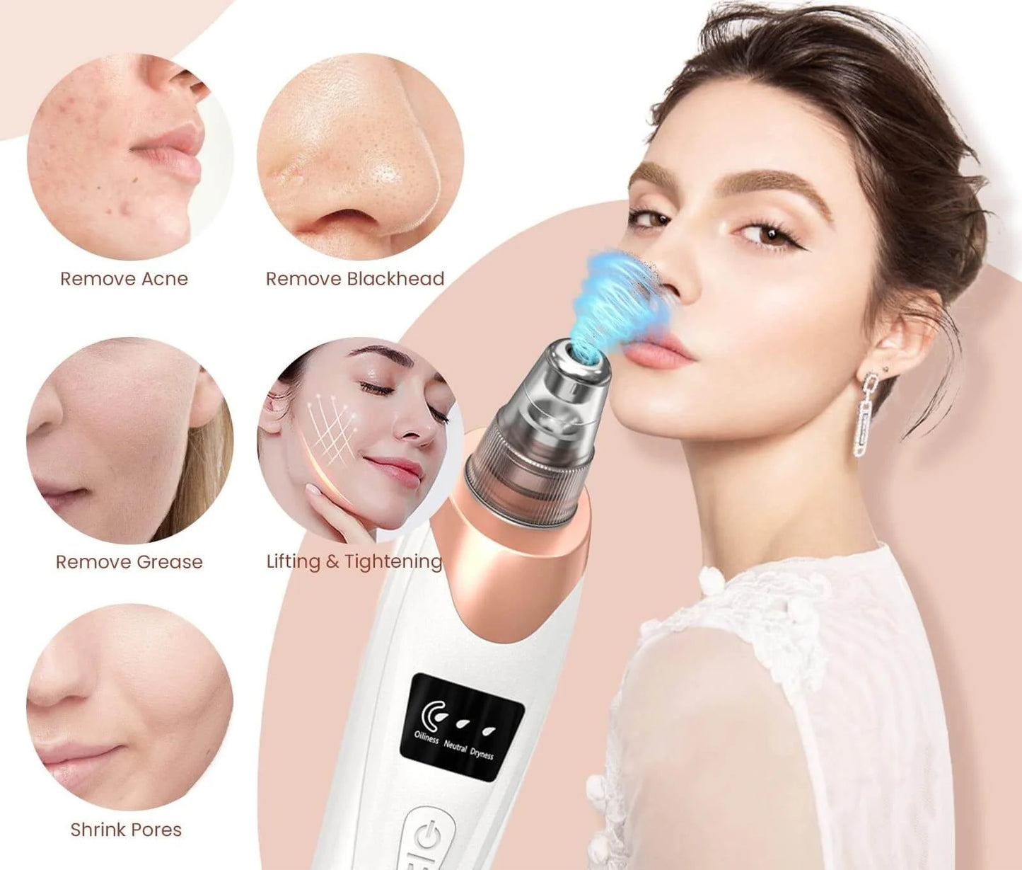Electric 5-in-1 Acne & Blackhead Remover