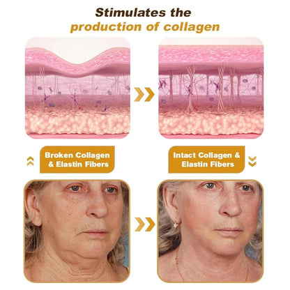 Botox Bee Venom Wrinkle Repair Ceam