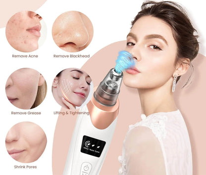 Electric 5-in-1 Acne & Blackhead Remover